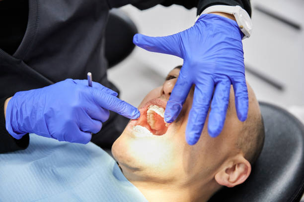 Best Emergency Dental Care for Broken or Chipped Teeth in Arcola, TX